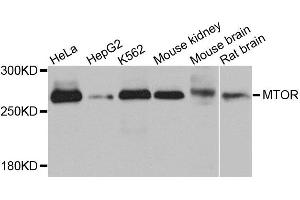 Western blot analysis of extracts of various cells, using MTOR antibody. (MTOR anticorps)