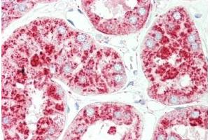 Human Kidney: Formalin-Fixed, Paraffin-Embedded (FFPE)