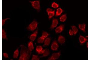 ABIN6267387 staining Hela by IF/ICC.