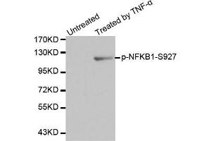 Western Blotting (WB) image for anti-Nuclear Factor of kappa Light Polypeptide Gene Enhancer in B-Cells 1 (NFKB1) (pSer927) antibody (ABIN1870466) (NFKB1 anticorps  (pSer927))