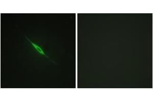 Immunofluorescence analysis of NIH-3T3 cells, using PKC delta (Phospho-Tyr52) Antibody. (PKC delta anticorps  (pTyr52))