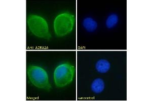 ABIN185577 Immunofluorescence analysis of paraformaldehyde fixed MCF7 cells, permeabilized with 0. (ADRA2A anticorps  (Internal Region))