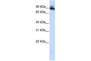WB Suggested Anti-SP4 Antibody Titration:  0. (SP4 anticorps  (Middle Region))