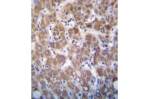 APOC2 Antibody immunohistochemistry analysis in formalin fixed and paraffin embedded human liver tissue followed by peroxidase conjugation of the secondary antibody and DAB staining. (Apolipoprotein C-II anticorps  (AA 45-73))