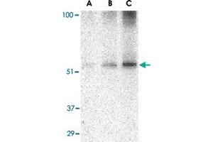 Western blot analysis of TANK in Daudi cell lysate with TANK polyclonal antibody  at (A) 0. (TANK anticorps  (C-Term))