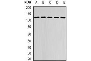 Western blot analysis of DHTKD1 expression in MCF7 (A), HepG2 (B), mouse brain (C), mouse kidney (D), rat liver (E) whole cell lysates. (DHTKD1 anticorps)