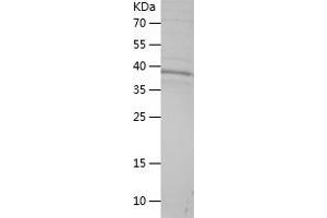 Western Blotting (WB) image for Dihydrolipoyl Transacetylase (DLAT) (AA 169-273) protein (His-IF2DI Tag) (ABIN7122666)