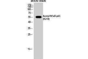 Western Blotting (WB) image for anti-Nuclear Factor-kB p65 (NFkBP65) (acLys218) antibody (ABIN3172840) (NF-kB p65 anticorps  (acLys218))