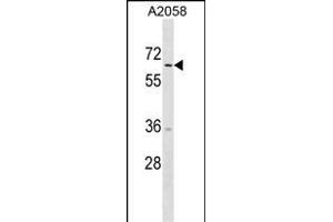 TRIM35 Antibody (C-term) (ABIN1537330 and ABIN2850370) western blot analysis in  cell line lysates (35 μg/lane). (TRIM35 anticorps  (C-Term))