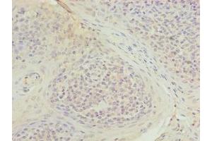 Immunohistochemistry of paraffin-embedded human tonsil tissue using ABIN7173675 at dilution of 1:100 (TUBB1 anticorps  (AA 270-451))