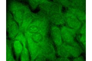 Immunocytochemistry/Immunofluorescence analysis using Mouse Anti-SHANK3 Monoclonal Antibody, Clone S69-46 . (SHANK3 anticorps  (AA 840-857) (PE))