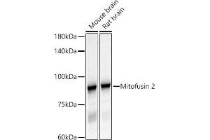 Western blot analysis of extracts of various cell lines, using Mitofusin 2 antibody (ABIN6133825, ABIN6143800, ABIN6143803 and ABIN6216518) at 1:500 dilution. (MFN2 anticorps  (AA 500-600))