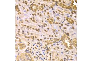 Immunohistochemistry of paraffin-embedded rat kidney using MAP2K7 antibody at dilution of 1:100 (x400 lens). (MAP2K7 anticorps)