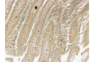 ABIN6265405 and ABIN6273327 at 1/100 staining human normal colon tissue by IHC-P.