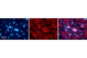 Rabbit Anti-NFATC1 Antibody    Formalin Fixed Paraffin Embedded Tissue: Human Adult heart  Observed Staining: Cytoplasmic,Nuclear (nuclear membrane) Primary Antibody Concentration: 1:600 Secondary Antibody: Donkey anti-Rabbit-Cy2/3 Secondary Antibody Concentration: 1:200 Magnification: 20X Exposure Time: 0.