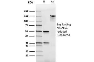 anti-IGHA1 & IGHA2 antibody