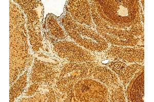 ABIN6262905, ABIN6268707, ABIN6268708 and ABIN6268709 at 1/100 staining Rat ovary tissue by IHC-P. (Lamin B1 anticorps)