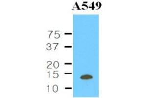 Western Blotting (WB) image for anti-Cystatin B (Stefin B) (CSTB) (AA 1-98), (N-Term) antibody (ABIN263931)
