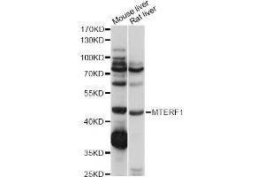 Western blot analysis of extracts of various cell lines, using MTERF1 antibody (ABIN6291170) at 1:1000 dilution. (MTERF anticorps)
