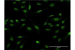 Immunofluorescence of monoclonal antibody to LMO4 on HeLa cell. (LMO4 anticorps  (AA 1-165))
