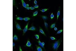 Immunofluorescent analysis of Peroxiredoxin 1 staining in Hela cells. (Peroxiredoxin 1 anticorps)