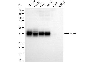 Western blotting analysis using M6PR antibody (ABIN7799331). (M6PR anticorps)