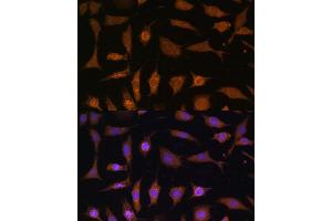 Immunofluorescence analysis of L929 cells using PDE6D Polyclonal Antibody (ABIN7269303) at dilution of 1:100 (40x lens).