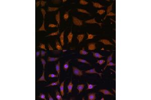 Immunofluorescence analysis of L929 cells using PDE6D Polyclonal Antibody (ABIN7269303) at dilution of 1:100 (40x lens). (PDE6D anticorps  (AA 1-150))
