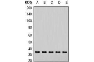 Western blot analysis of SNAP-alpha expression in Hela (A), Jurkat (B), mouse brain (C), mouse lung (D), rat liver (E) whole cell lysates. (NAPA anticorps)