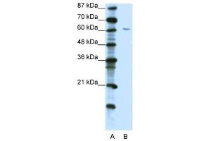 ZNF286 antibody (20R-1219) used at 5 ug/ml to detect target protein.
