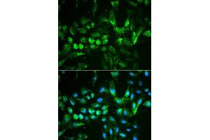 Immunofluorescence analysis of MCF7 cell using TIMP2 antibody. (TIMP2 anticorps  (AA 100-200))