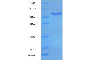 SDS-PAGE (SDS) image for Signal-Regulatory Protein alpha (SIRPA) (AA 31-373) protein (His-SUMO Tag) (ABIN5710362)