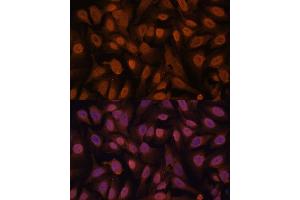 Immunofluorescence analysis of U-2 OS cells using ZNF131 antibody (ABIN7271453) at dilution of 1:100.