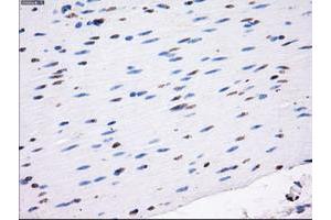 Image no. 5 for anti-Lysyl Oxidase (LOX) (AA 22-168) antibody (ABIN1491218)