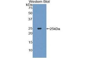 Detection of Recombinant IL27, Mouse using Polyclonal Antibody to Interleukin 27A (IL27A) (IL27 anticorps  (AA 29-234))