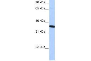 Western Blot showing ZNF389 antibody used at a concentration of 1-2 ug/ml to detect its target protein. (ZNF192P1 anticorps  (N-Term))