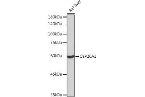 Western blot analysis of extracts of Rat liver, using CYP26 Rabbit mAb (ABIN7266654) at 1:1000 dilution. (CYP26A1 anticorps)