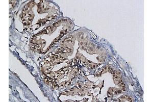 Immunohistochemistry (IHC) image for anti-Minichromosome Maintenance Complex Component 2 (MCM2) (AA 601-700) antibody (ABIN676238) (MCM2 anticorps  (AA 601-700))