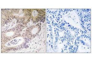 Immunohistochemistry (IHC) image for anti-Ribosomal Protein S6 Kinase, 90kDa, Polypeptide 5 (RPS6KA5) (Ser212) antibody (ABIN1848238)