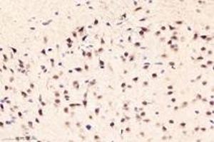 Immunohistochemistry analysis of paraffin-embedded rat prefrontal lobe using,DAZAP1 (ABIN7073691) at dilution of 1: 6000