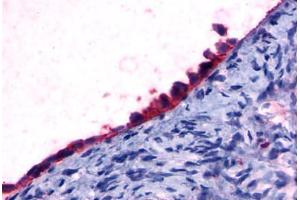 Anti-GPR108 antibody  ABIN1048687 IHC staining of human ovary, surface epithelium. (GPR108 anticorps  (Cytoplasmic Domain))