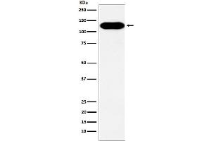 Western blot analysis of BCAR1 expression in A431 cell lysate.