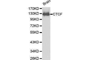 Western Blotting (WB) image for anti-CCCTC-Binding Factor (Zinc Finger Protein) (CTCF) (AA 1-260) antibody (ABIN6215164) (CTCF anticorps  (AA 1-260))