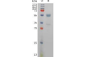 Human CD94 Protein, hFc Tag on SDS-PAGE under reducing condition.