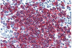 Human Tonsil (formalin-fixed, paraffin-embedded) stained with MS4A1 antibody ABIN790331 at 10 ug/ml followed by biotinylated goat anti-rabbit IgG secondary antibody ABIN481713, alkaline phosphatase-streptavidin and chromogen. (CD20 anticorps  (C-Term))