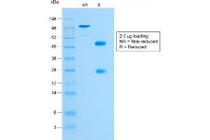 SDS-PAGE Analysis Purified Glycophorin A Rabbit Monoclonal Antibody (GYPA/1725R). (Recombinant CD235a/GYPA anticorps)
