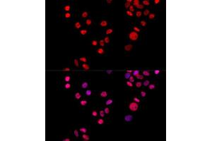 Immunofluorescence analysis of HeLa cells using XRCC6 antibody.