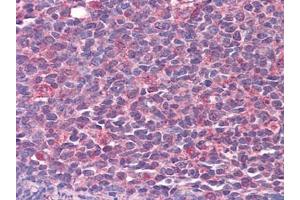 Immunohistochemistry (IHC) image for anti-Calcium/calmodulin-Dependent Protein Kinase II beta (CAMK2B) (AA 1-504) antibody (ABIN614553)