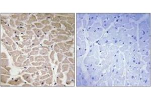 Immunohistochemistry analysis of paraffin-embedded human heart tissue, using Collagen XVI alpha1 Antibody.
