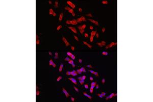 Immunofluorescence analysis of SH-SY5Y cells using PTPN5 Rabbit pAb (ABIN7269705) at dilution of 1:150 (40x lens). (PTPN5 anticorps  (AA 360-490))